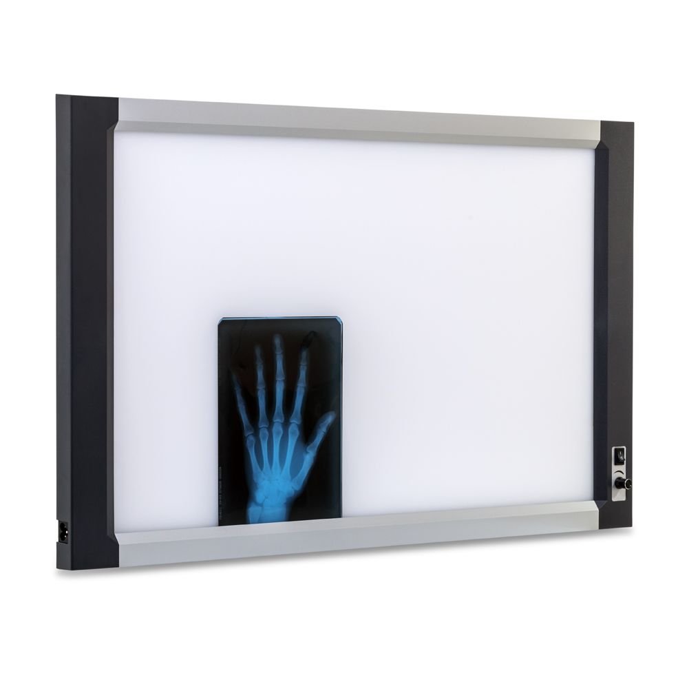 Негатоскоп Армед 2-кадровый 