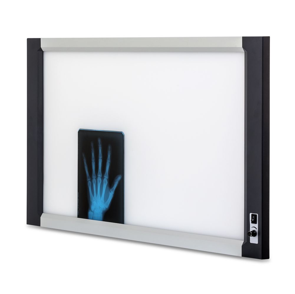 Негатоскоп Армед 2-кадровый 