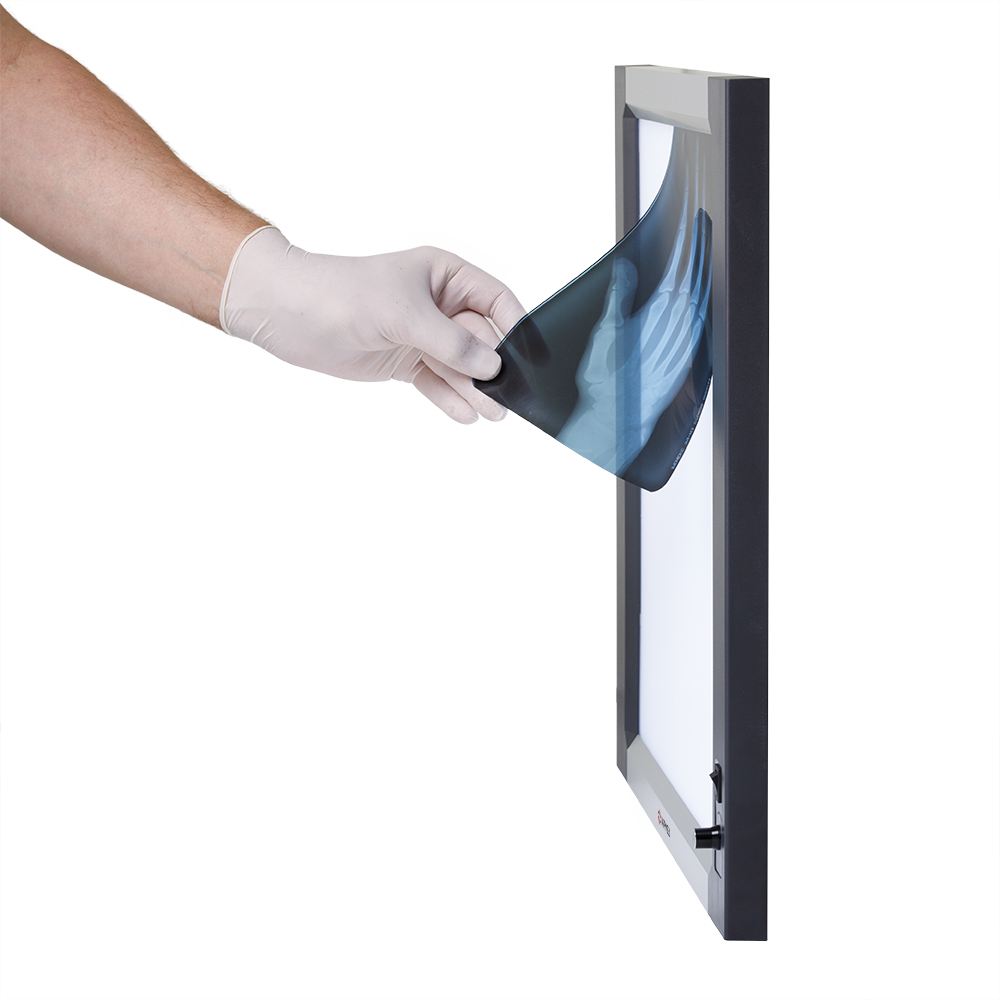 Негатоскоп общего назначения Армед 1-кадровый LUX 